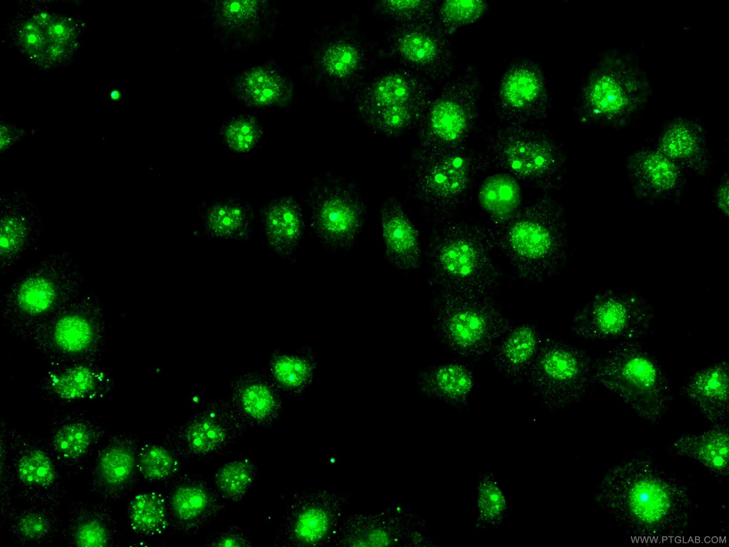 BOP1 Polyclonal antibody