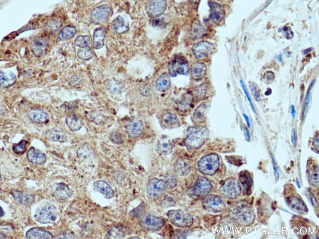 UPF1 Polyclonal antibody