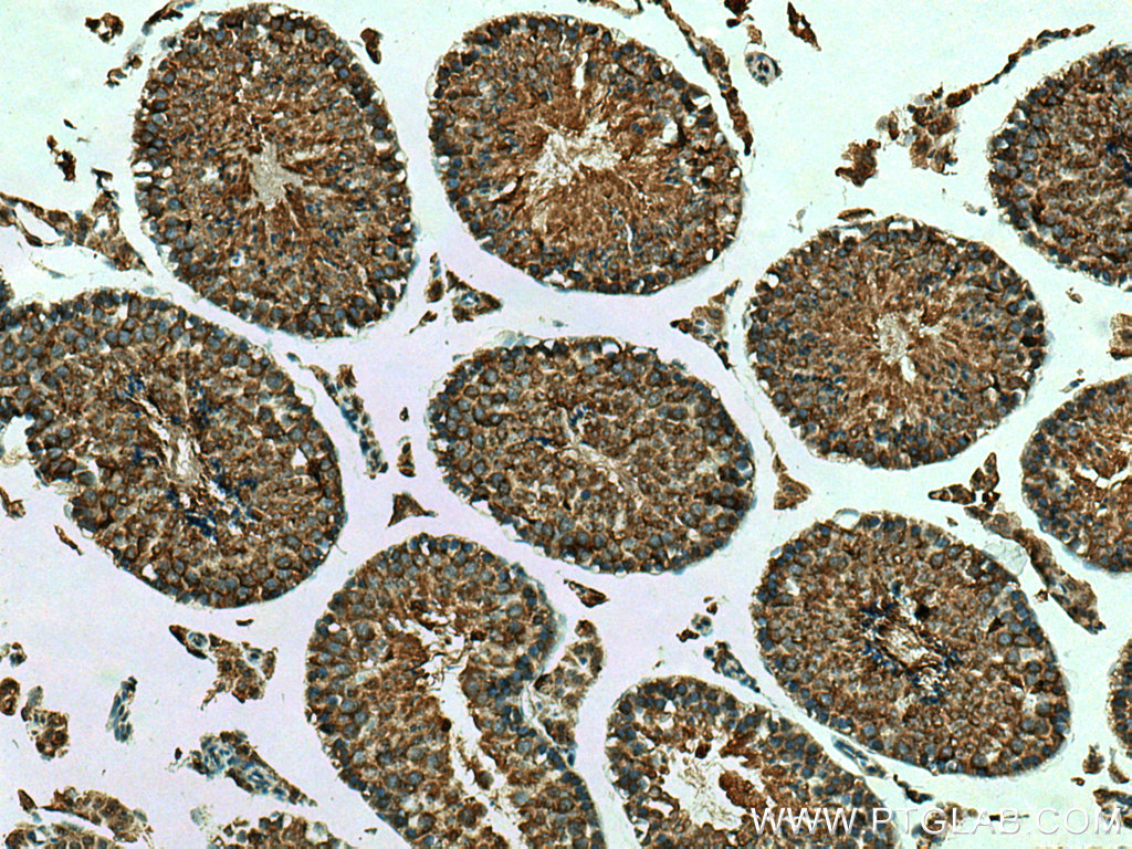 MSTO1 Polyclonal antibody