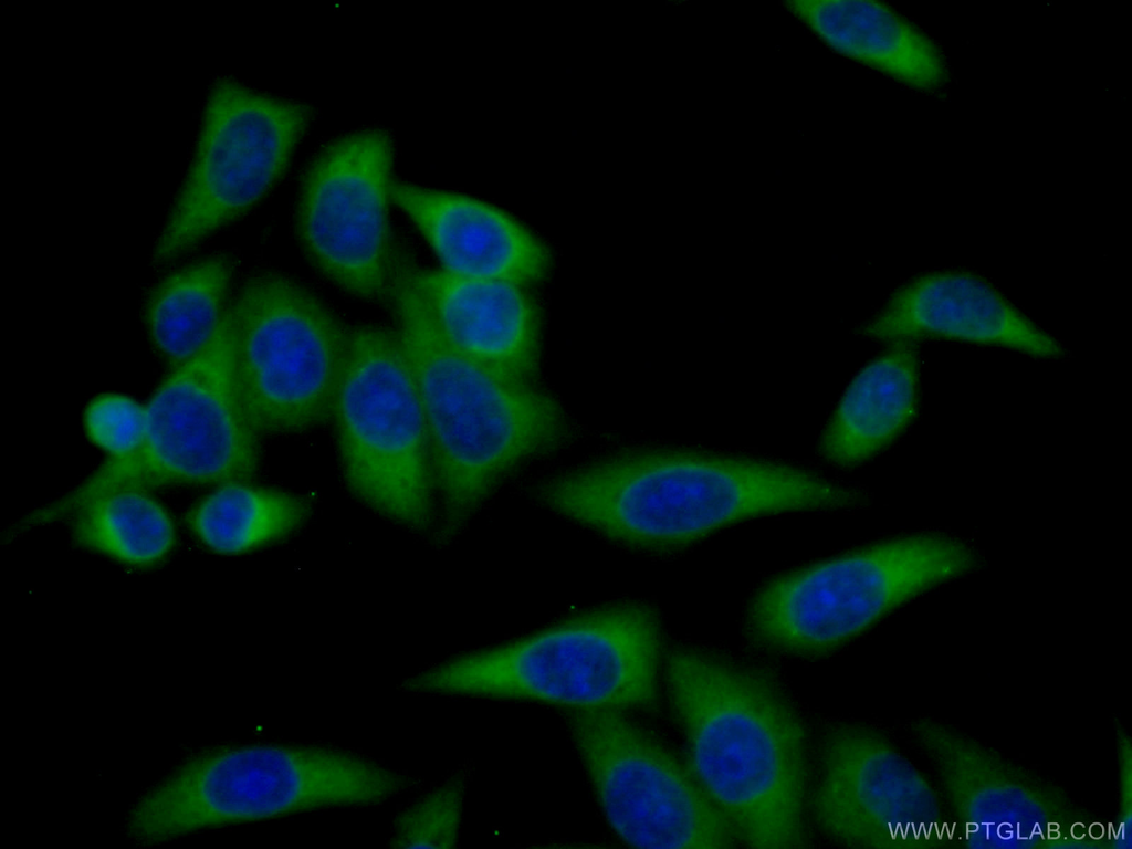 ARHGAP18 Polyclonal antibody