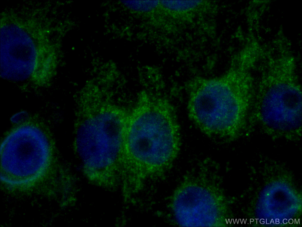 DST Polyclonal antibody