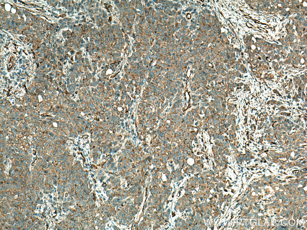 TPM1 Polyclonal antibody