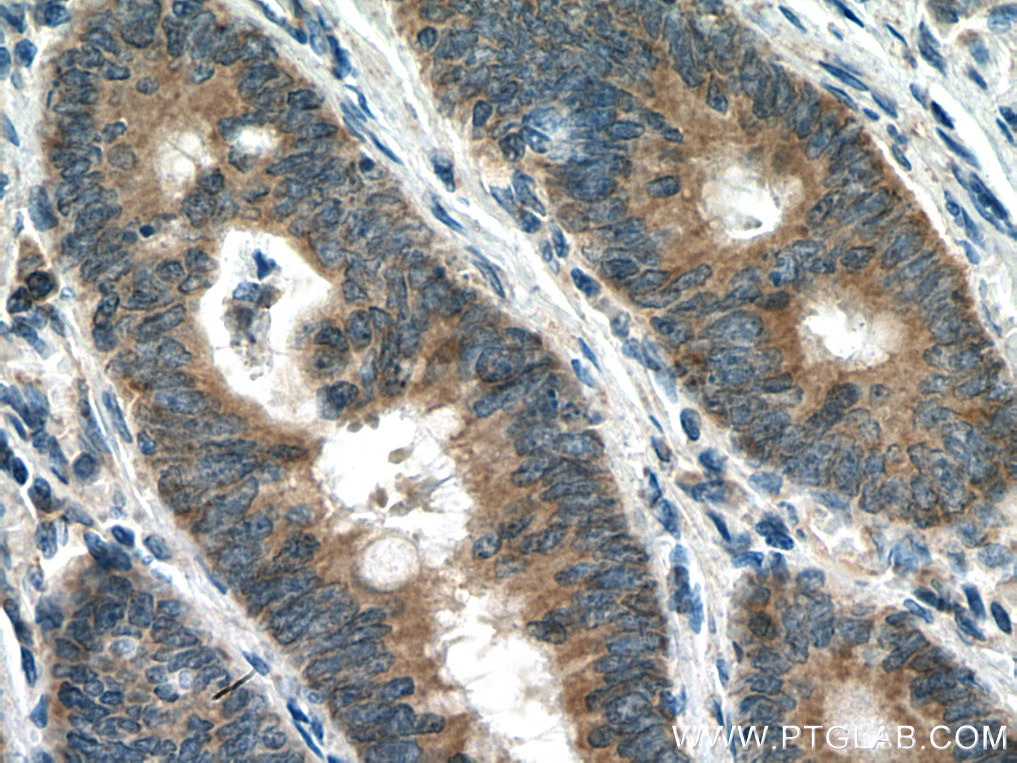 CARD11 Polyclonal antibody