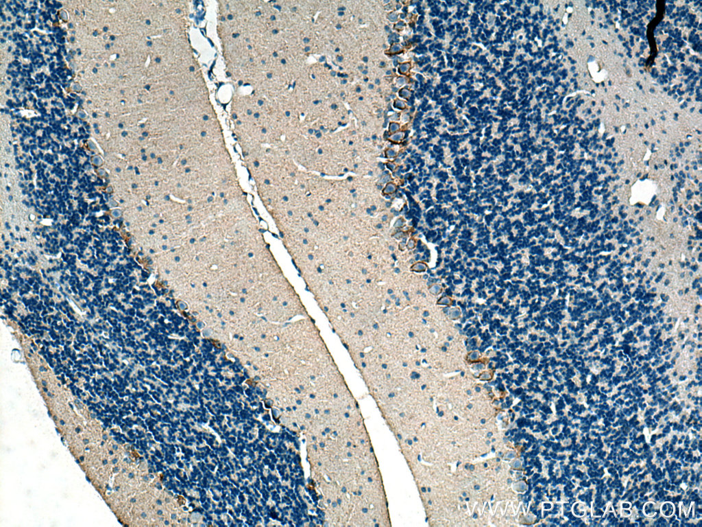 GAT1 Polyclonal antibody