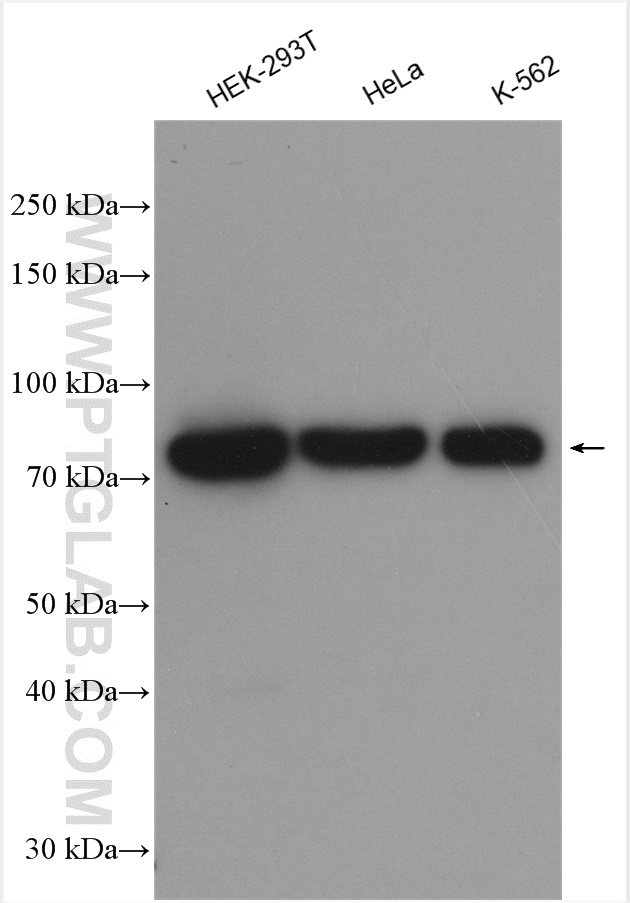 DDX18 Polyclonal antibody