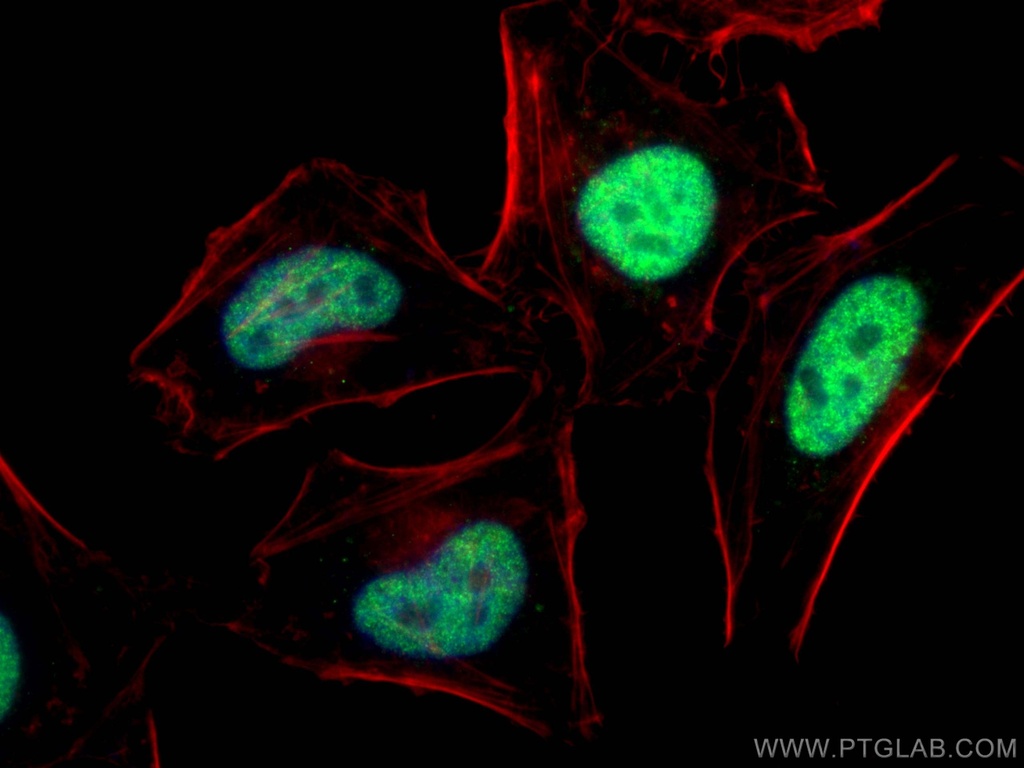 PRKDC Polyclonal antibody