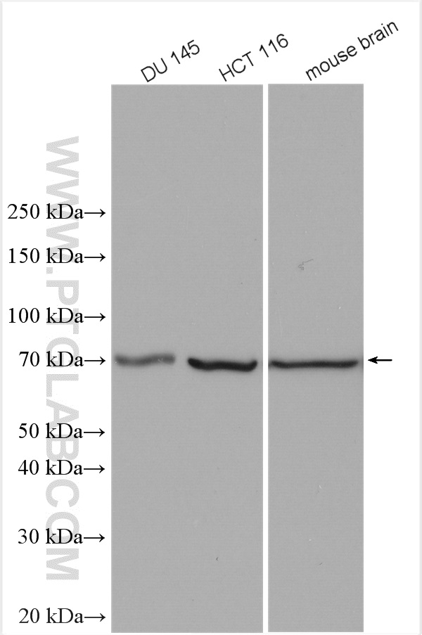 TCTN1 Polyclonal antibody