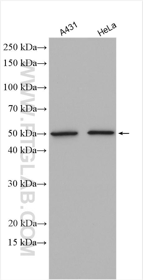 ATF4 Polyclonal antibody