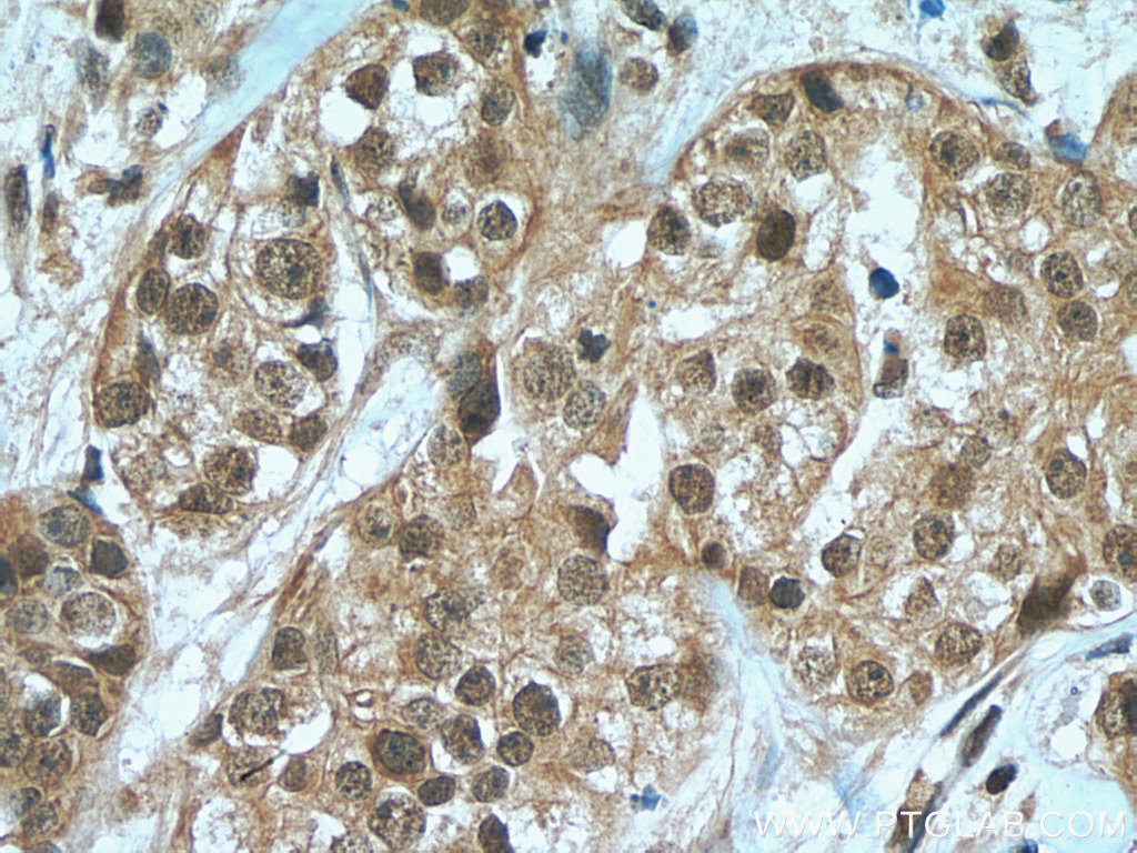 HORMAD1 Polyclonal antibody