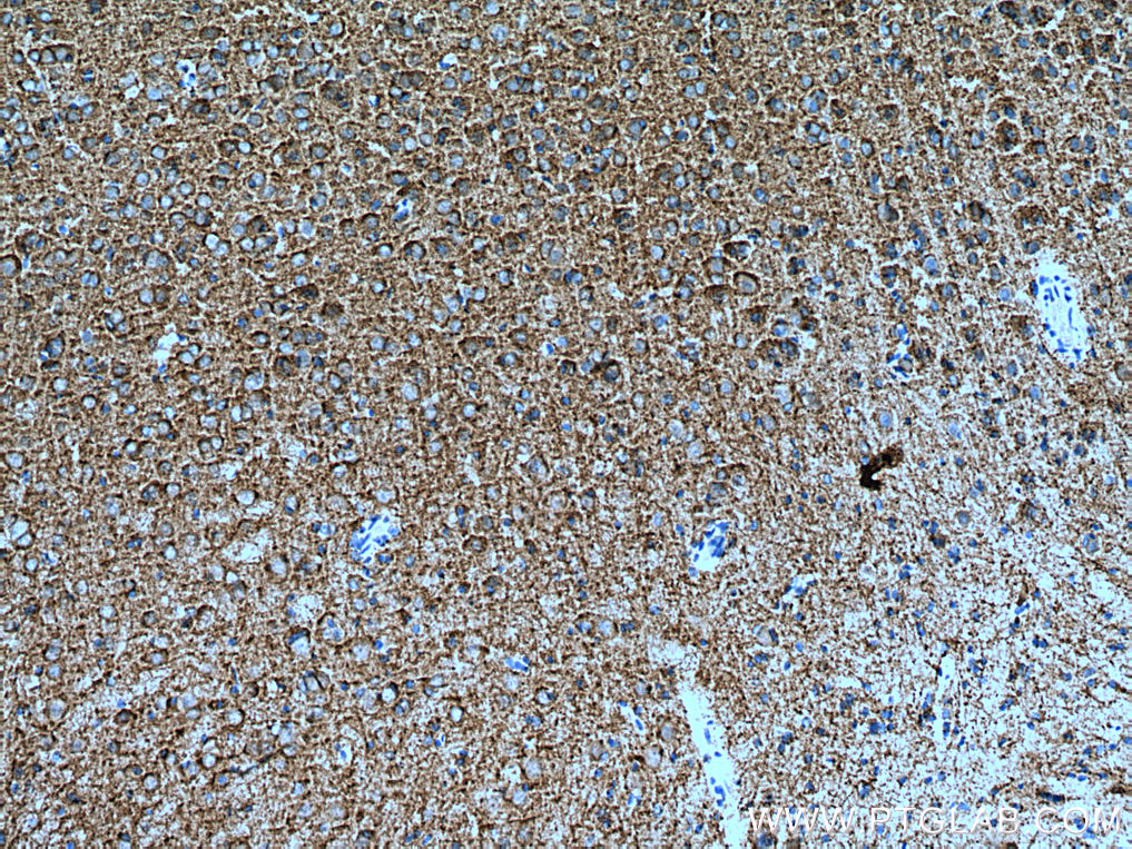 KCC2/SLC12A5 Polyclonal antibody