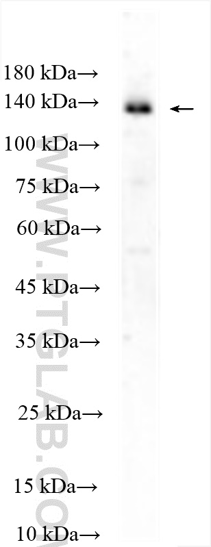 USP25 Polyclonal antibody