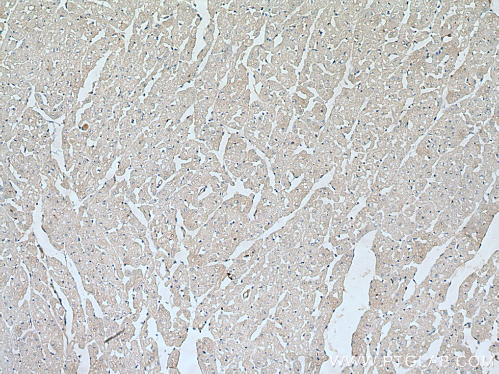 WIPI2 Polyclonal antibody