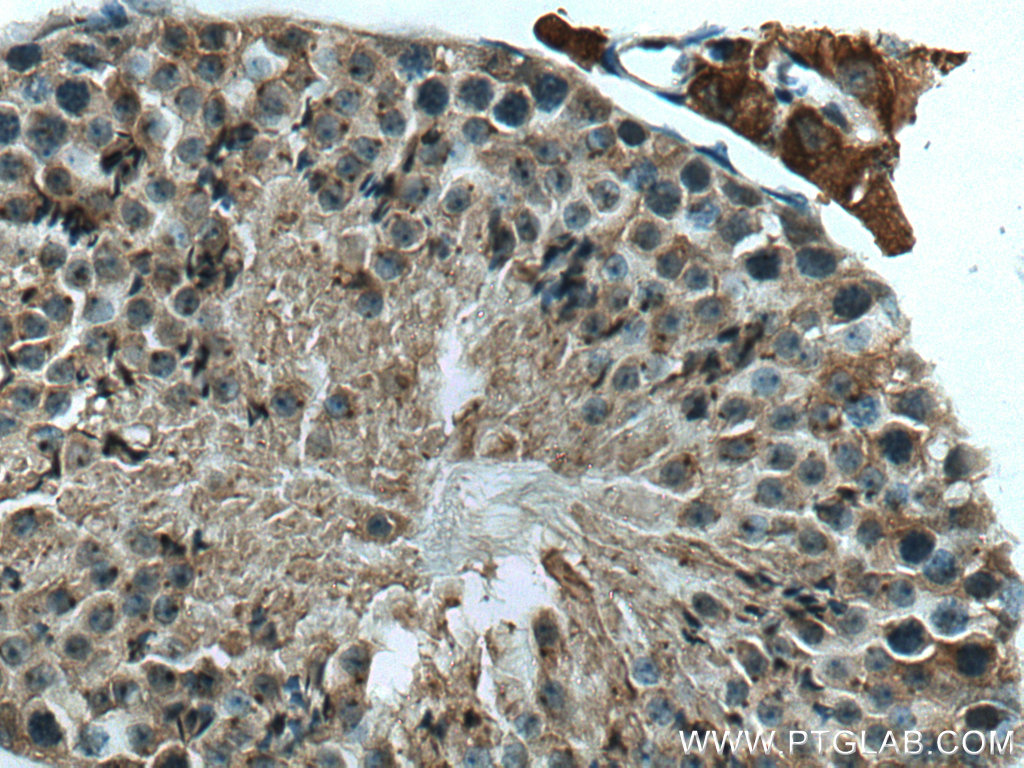 C6orf134 Polyclonal antibody