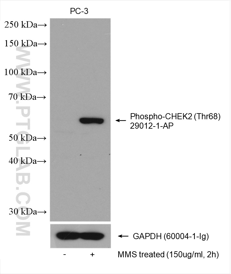 Phospho-CHEK2 (Thr68) Polyclonal antibody