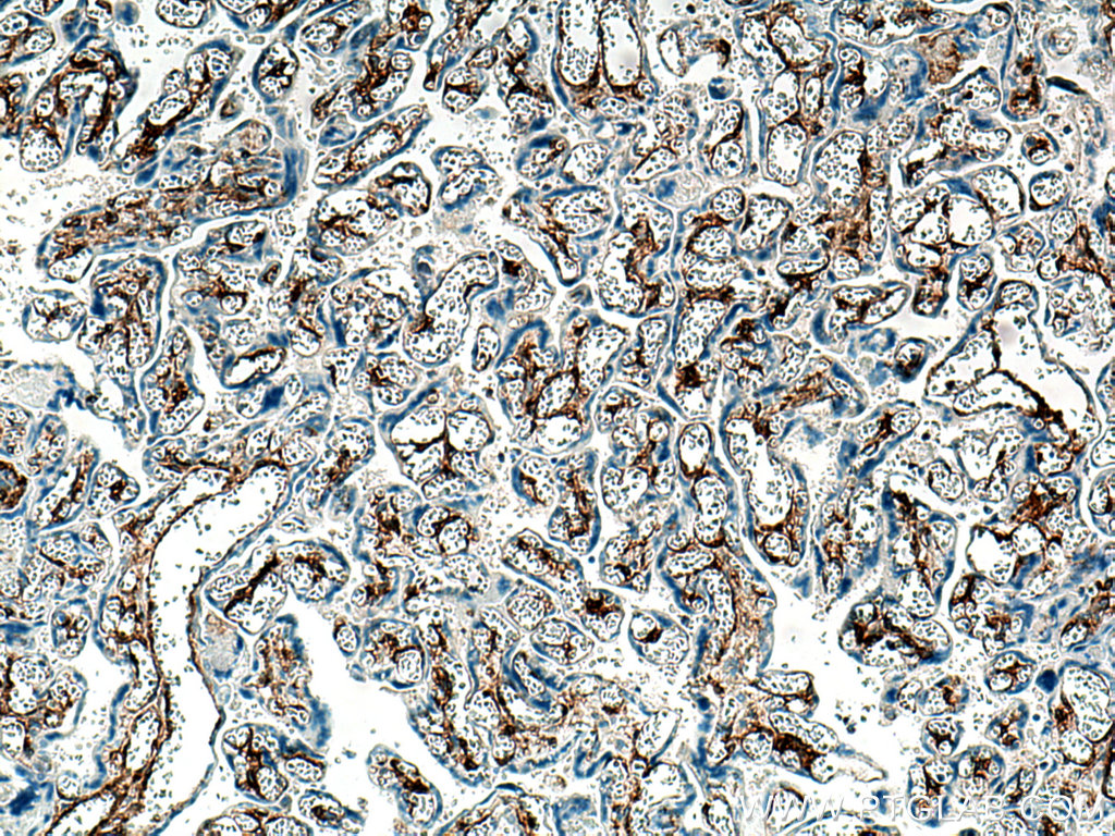 Integrin alpha-1 Polyclonal antibody