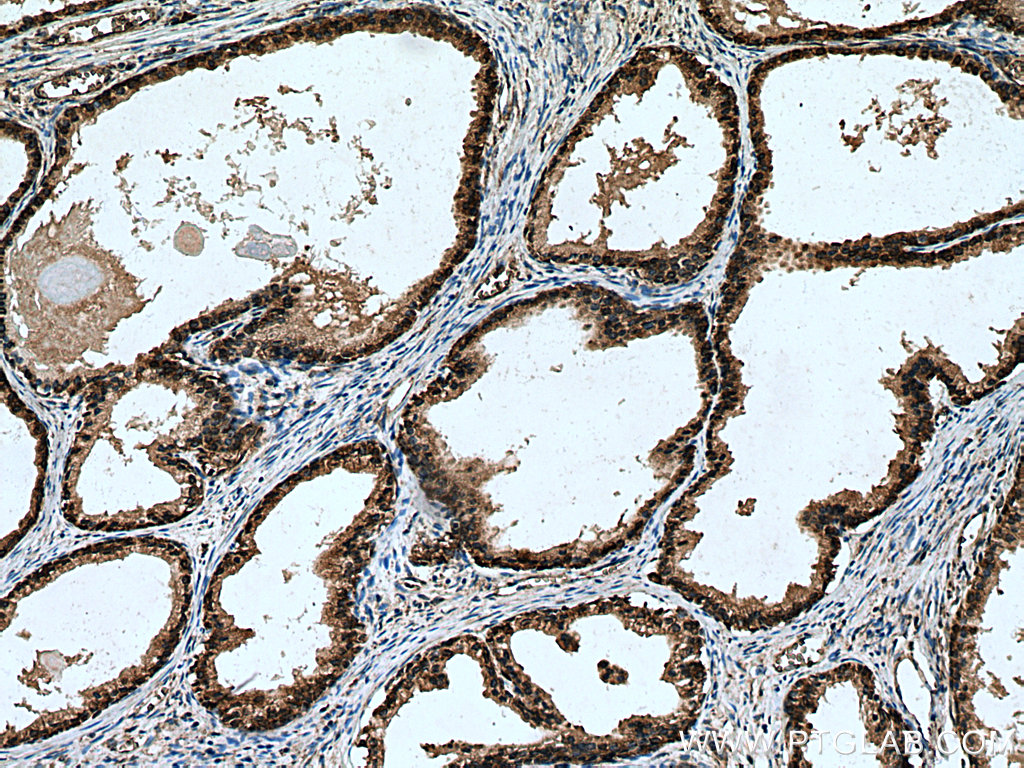 RPL5 Polyclonal antibody