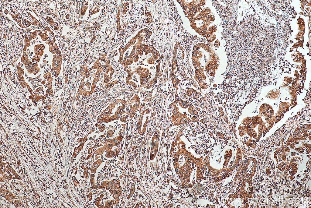 PTH1R Polyclonal antibody