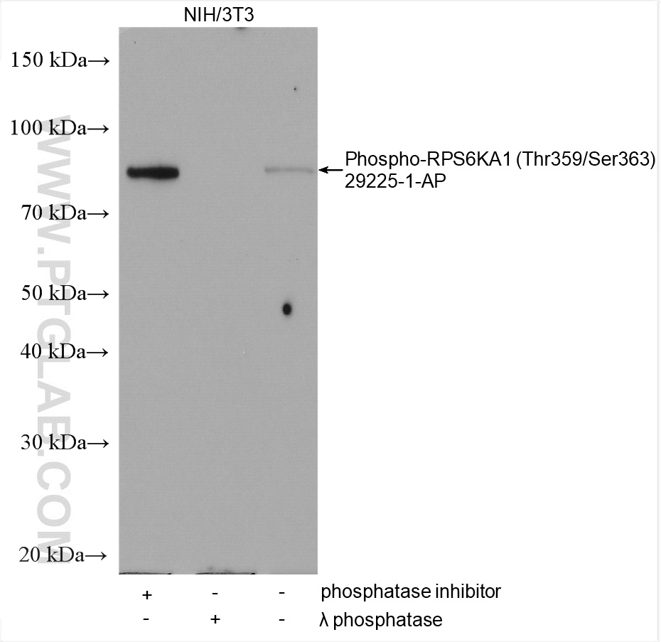 Phospho-RPS6KA1 (Thr359/Ser363) Polyclonal antibody
