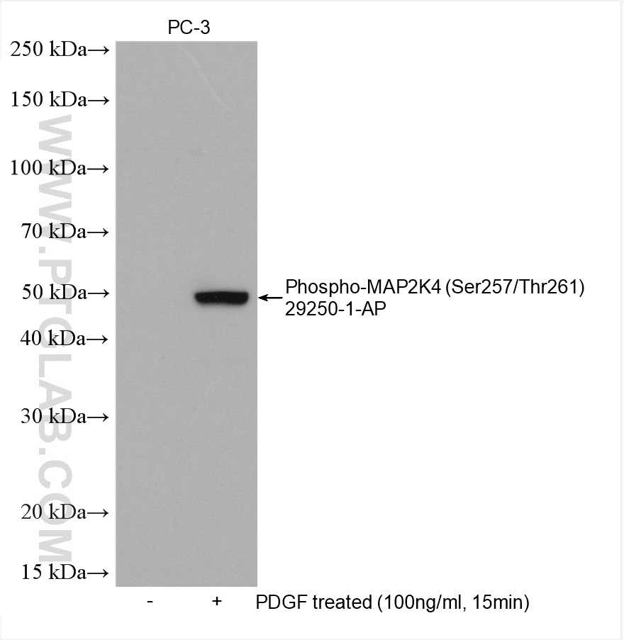Phospho-MAP2K4 (Ser257/Thr261) Polyclonal antibody
