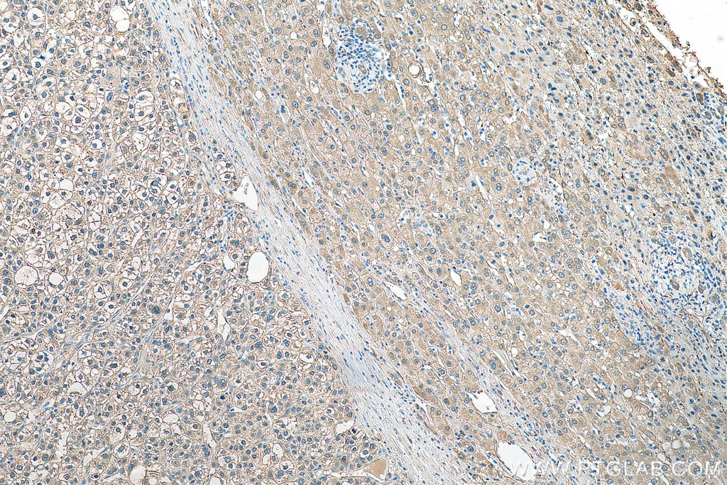 ALDH1A3 Polyclonal antibody