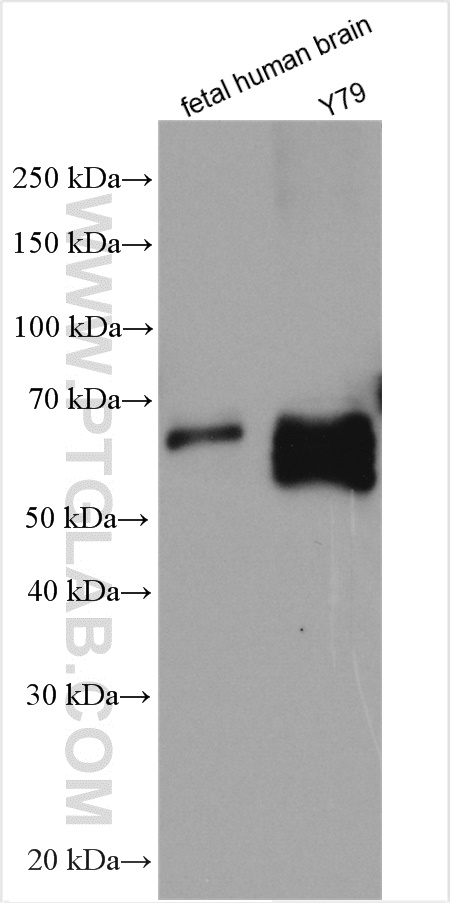 SOX11 Polyclonal antibody