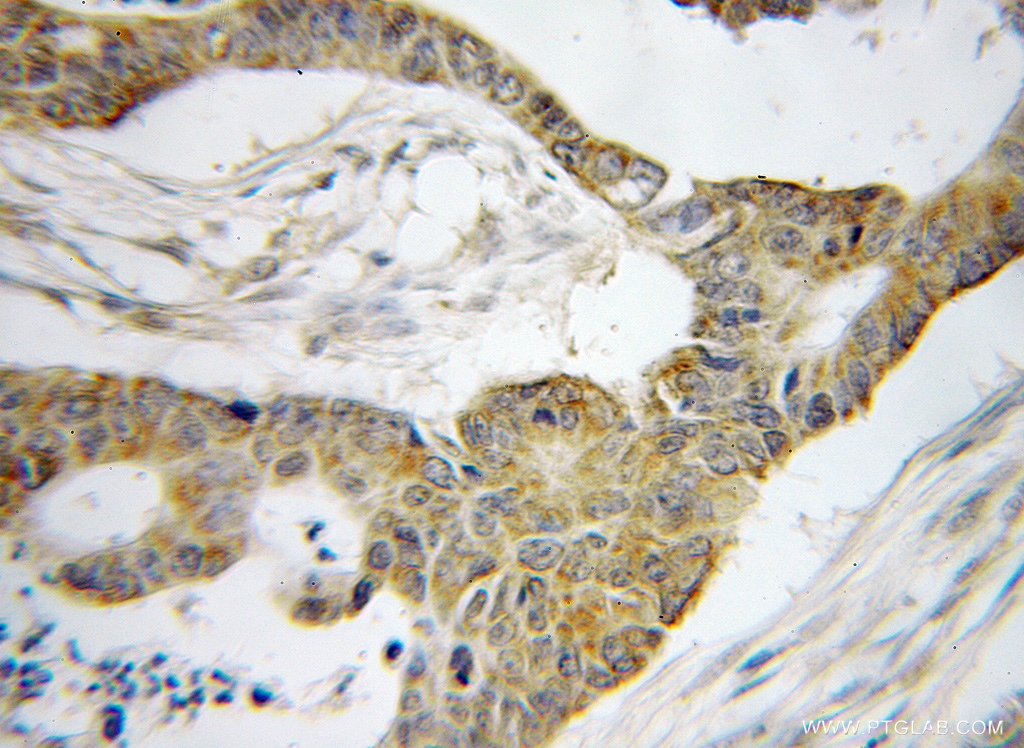 BRD7 Polyclonal antibody