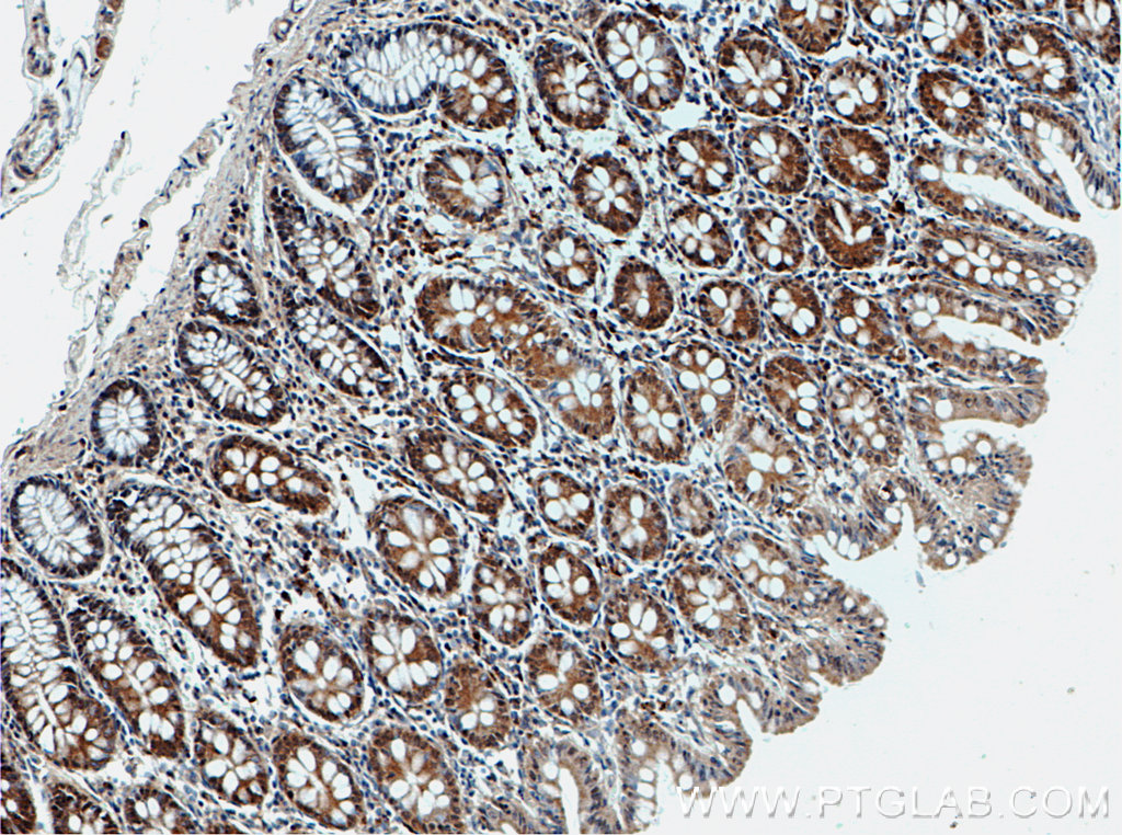 SPTLC2 Polyclonal antibody