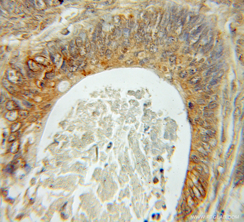 Fhl1 Polyclonal antibody