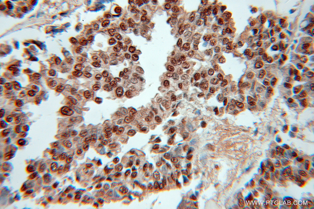 RPLP0 Polyclonal antibody