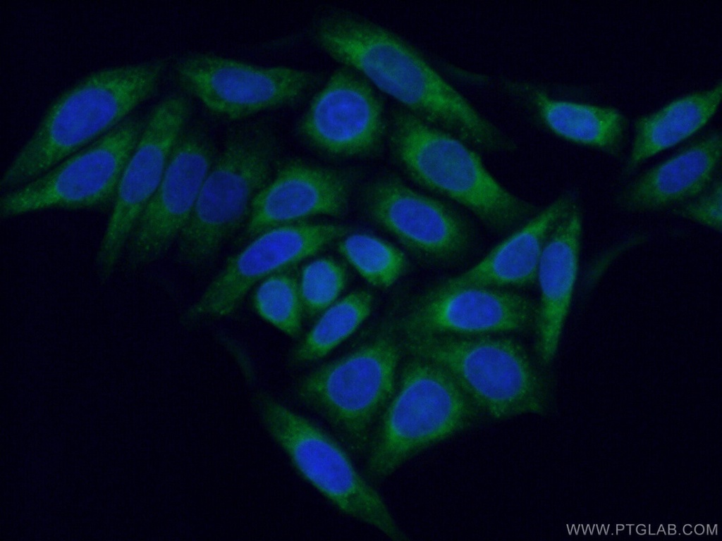 SEC61B Polyclonal antibody
