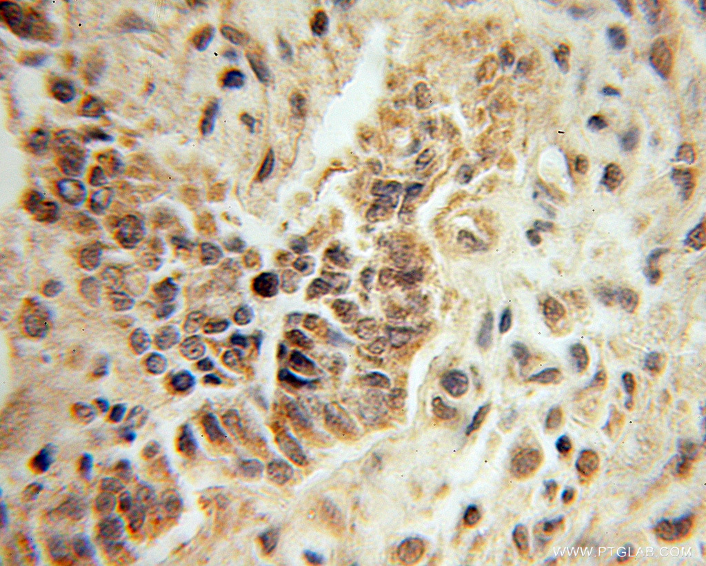 Mecr Polyclonal antibody
