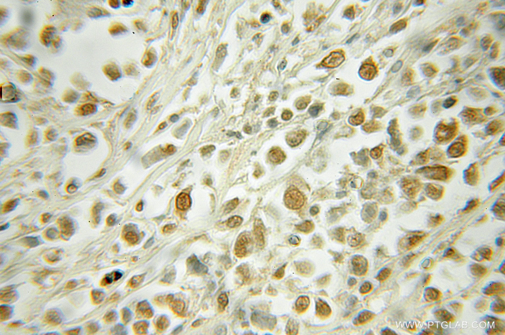 RAD23A Polyclonal antibody