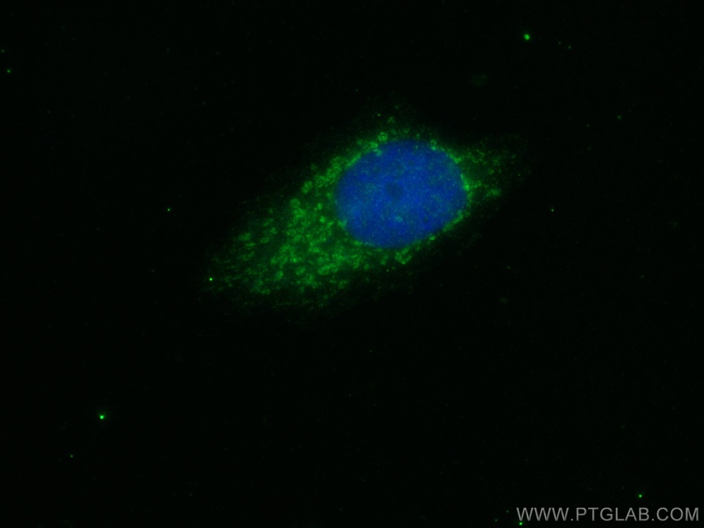SIK1 Polyclonal antibody