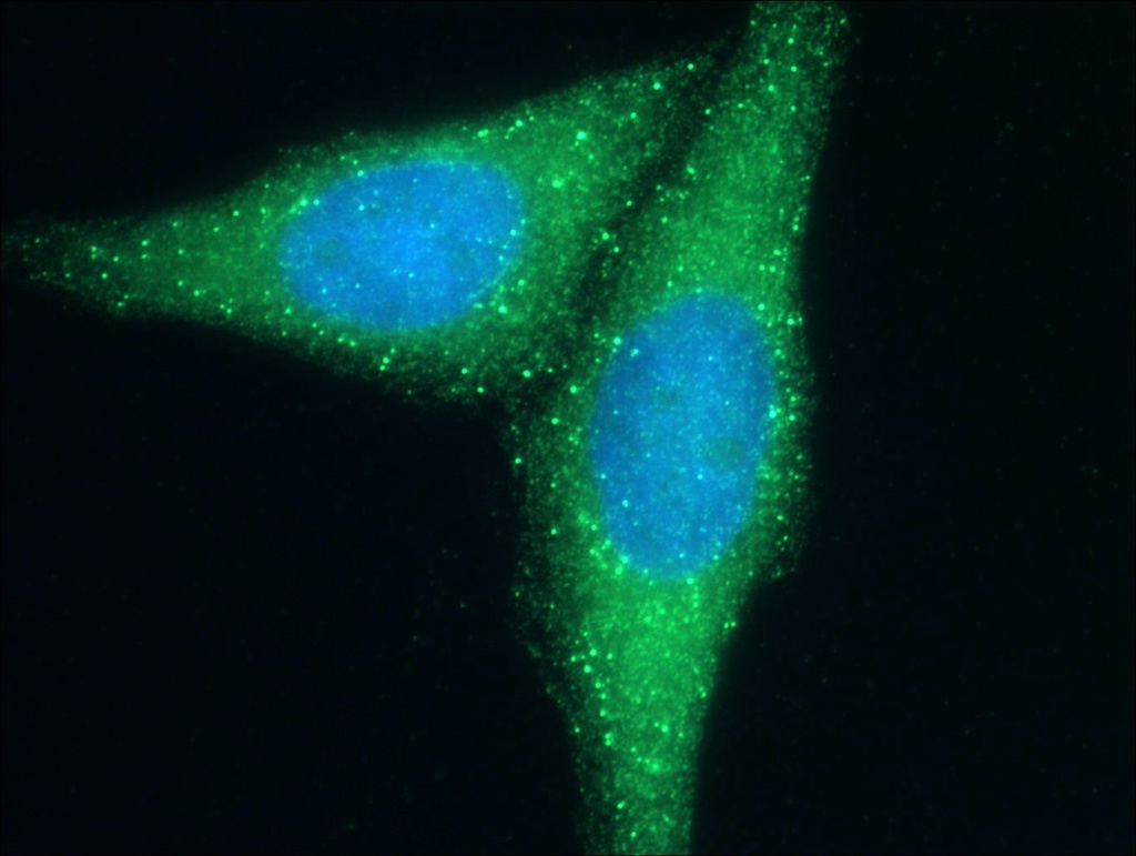 Cd2ap Polyclonal antibody