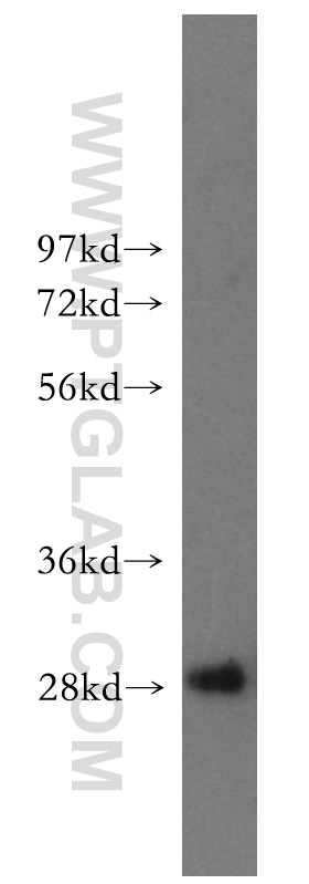 Hepsin Polyclonal antibody