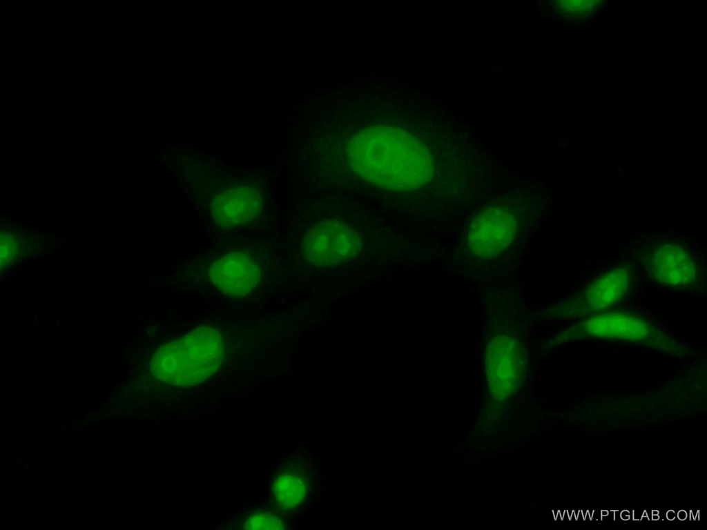 PHF6 Polyclonal antibody