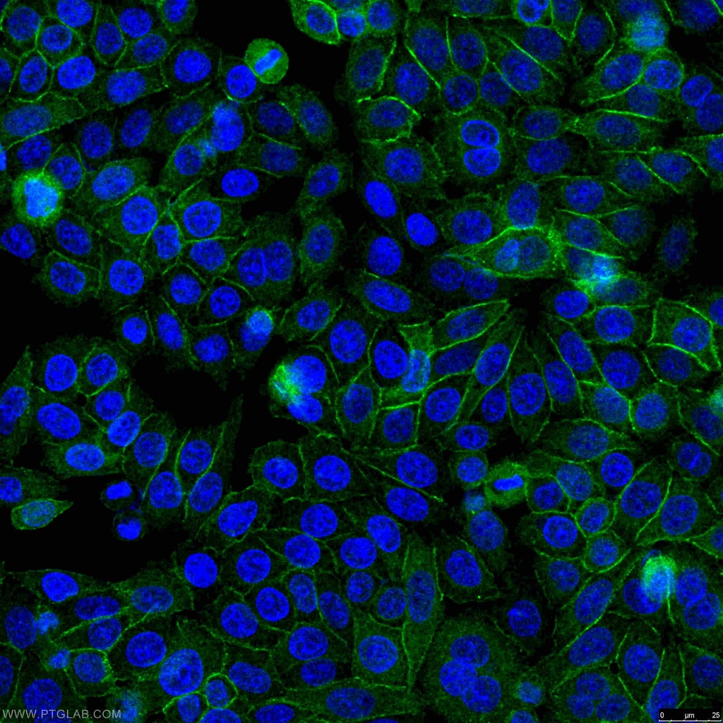 Beta Catenin Polyclonal antibody