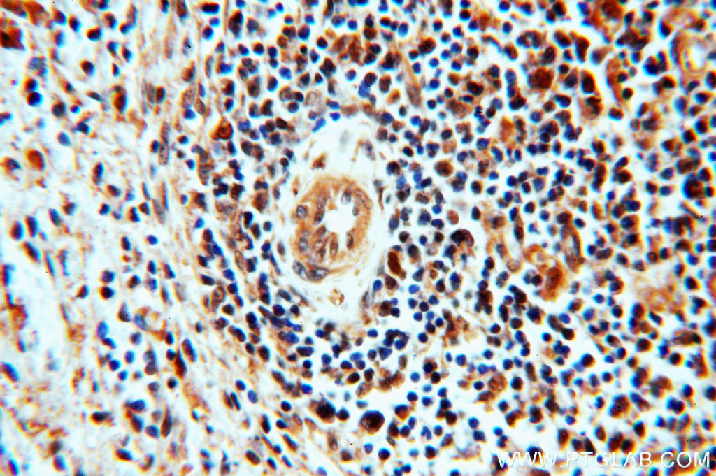 STAT6 Polyclonal antibody