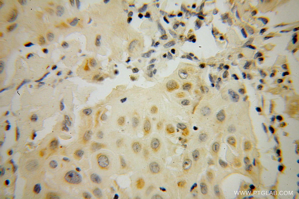 STAT5A Polyclonal antibody