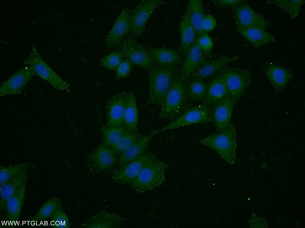 HER2/ErbB2 Polyclonal antibody
