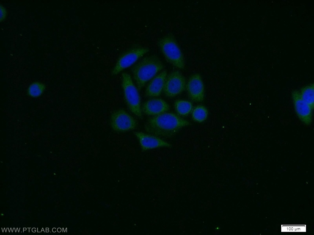 PAK1 Polyclonal antibody