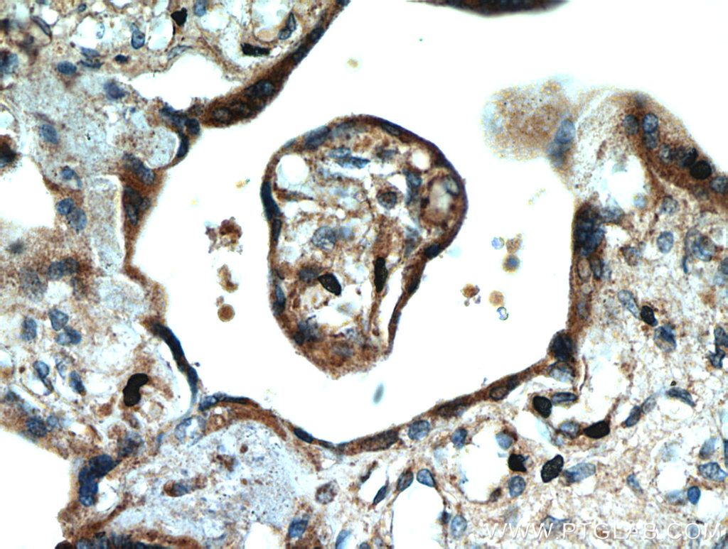 SMAD4 Polyclonal antibody