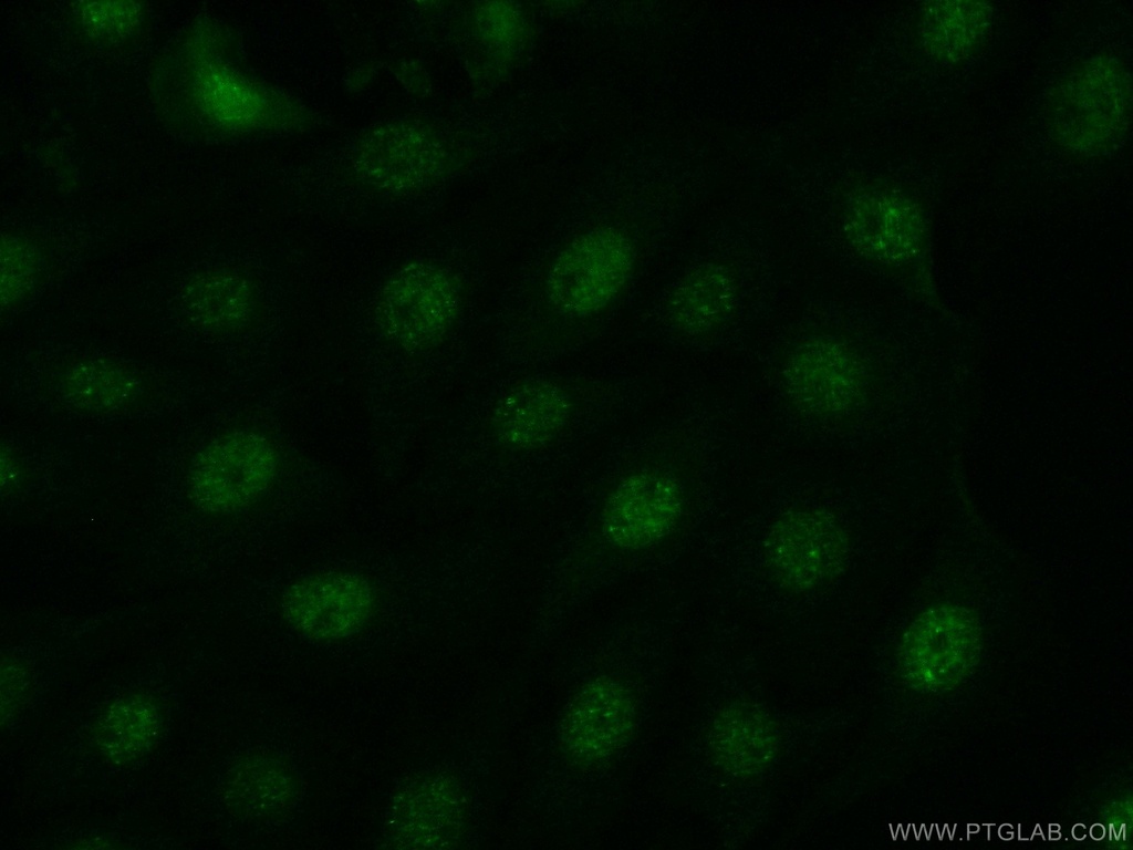 JNK Polyclonal antibody