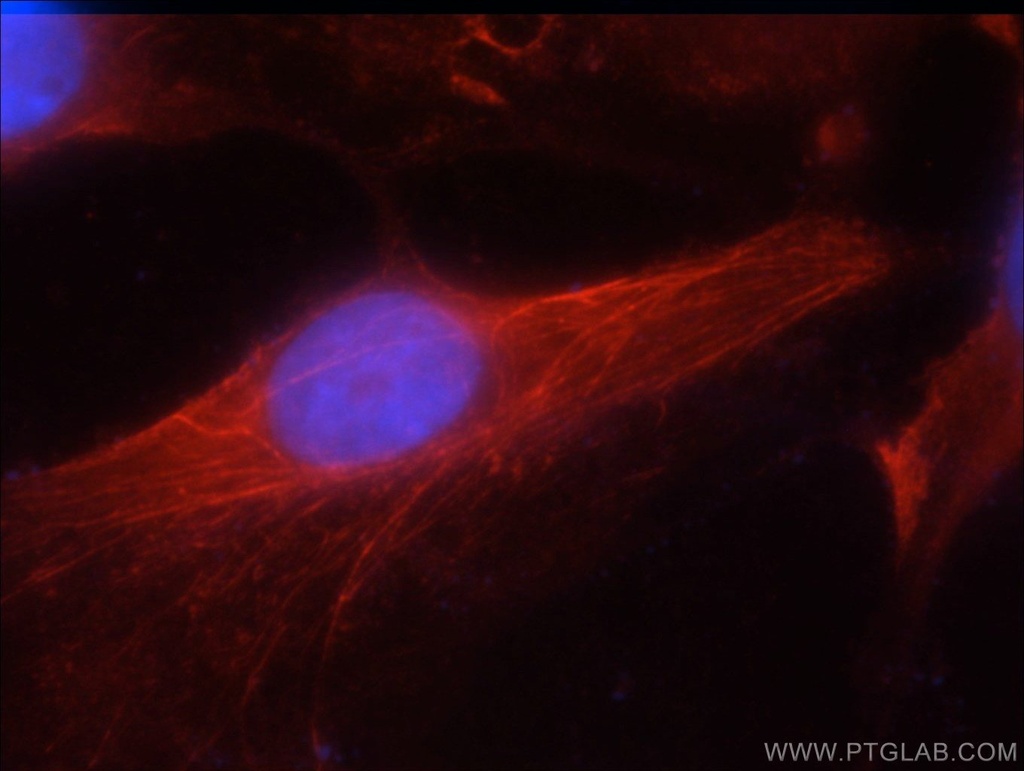 JNK2 Polyclonal antibody
