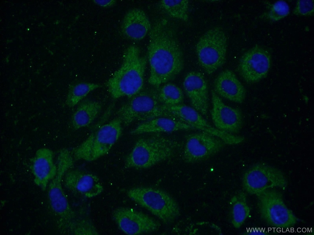 ELOVL4 Polyclonal antibody