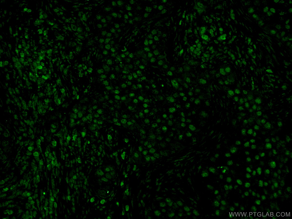 CDC25A Polyclonal antibody