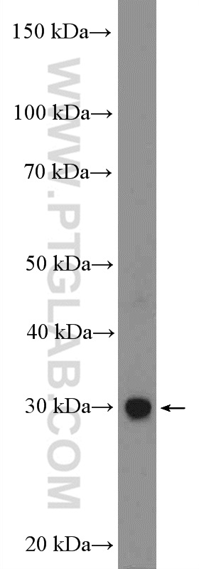 EMX1 Polyclonal antibody