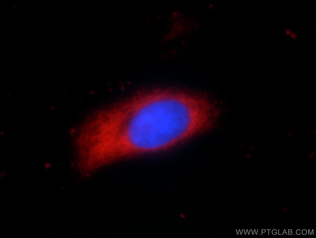 PYCR2 Polyclonal antibody