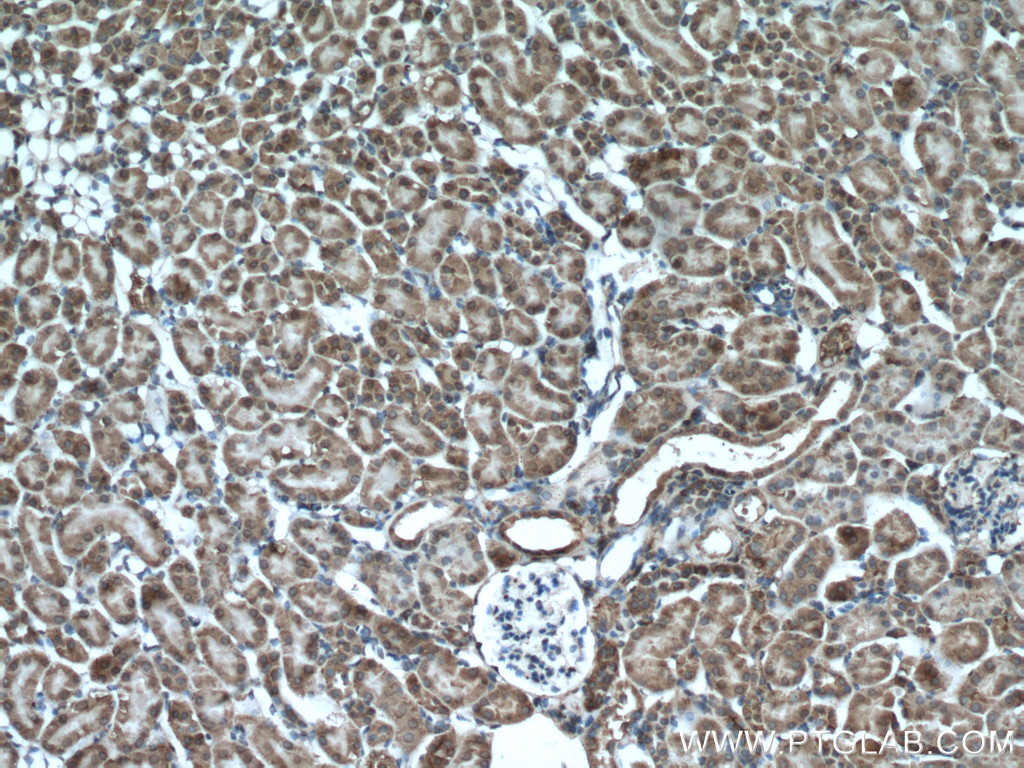 XYLT1 Polyclonal antibody