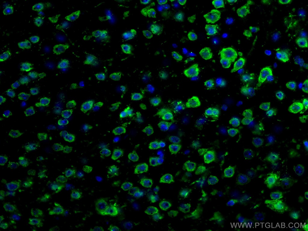 DRD2 Polyclonal antibody